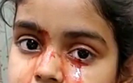 В Индии 11-летняя девочка плачет кровью, и никто не знает почему