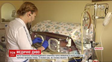 Миколаївські медики провели унікальну операцію новонародженому сироті