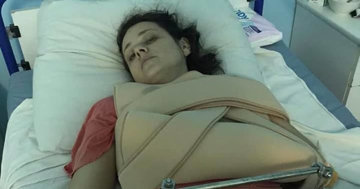 Не може рухатися: постраждалій у ДТП на зупинці у Києві зробили другу операцію