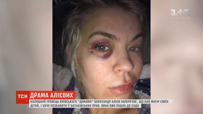 Екс-дружина футболіста Олександра Алієва звинувачує його в домашньому насильстві