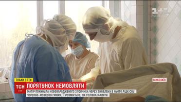 Лікарі з Миколаєва вирізали покинутому немовляті рідкісну черепно-мозкову грижу