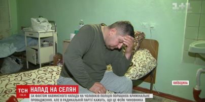 Председатель села на Киевщине обвиняет в своем избиении народного депутата