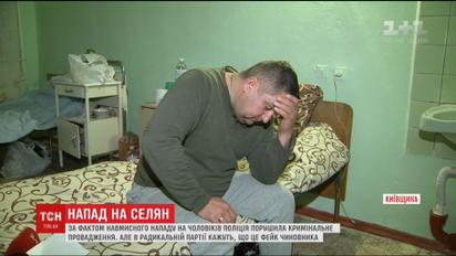 Председатель села на Киевщине обвиняет в своем избиении народного депутата