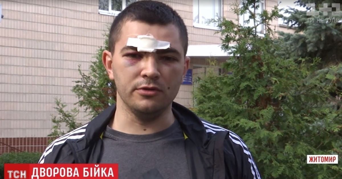 Подружжя кікбоксерів побило житомирського копа, який вступився за ображеного пенсіонера