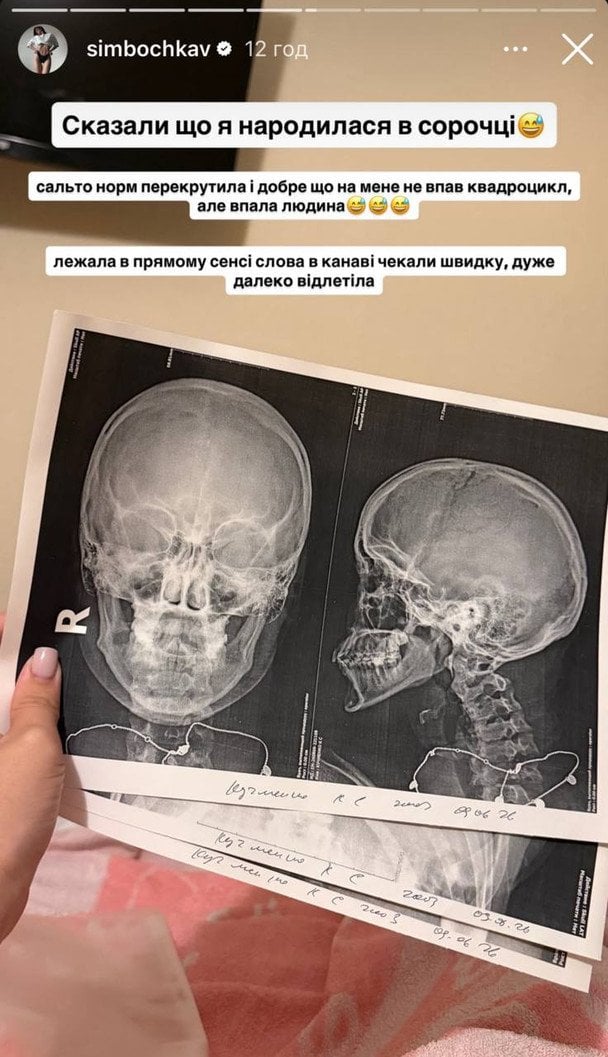 Сториз Сімбочки / © instagram.com/simbochkka