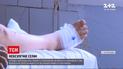 Новости Украины: 13-летнего подростка ударило током в 27 тысяч вольт при селфи на железнодорожном мосту