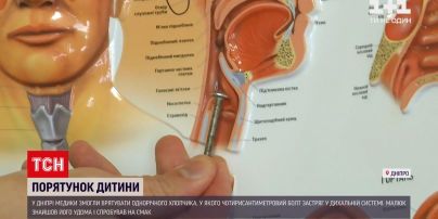 Новини України: у Дніпрі ледь встигли врятувати 1-річного малюка, який міг загинути через болт