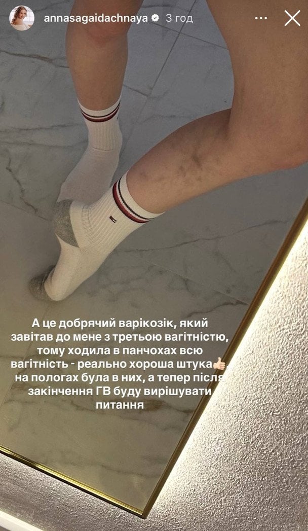 Анна Сагайдачна  / © instagram.com/annasagaidachnaya