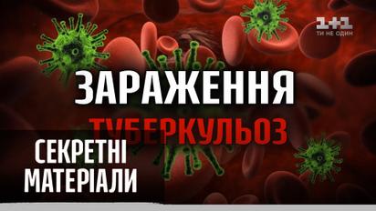 Пандемії світу: туберкульоз – Секретні матеріали
