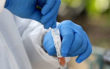 У Миколаєві медиків почали тестувати на наявність антитіл до коронавірусу