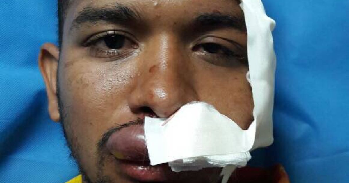 "Гумові кулі нас не зупинять". У Венесуелі поранили символа протесту - скрипаля Артегу