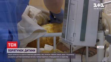 Состояние 3-летней девочки, которая получила страшные ожоги во время пожара в Днепре, остается крайне тяжелым
