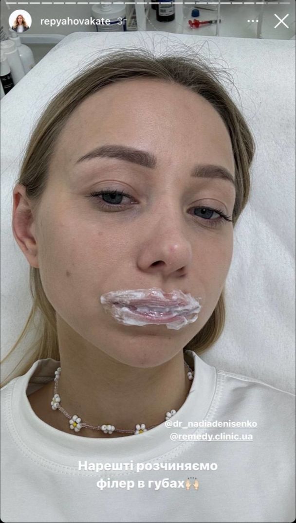 Екатерина Репяхова / © instagram.com/repyahovakate