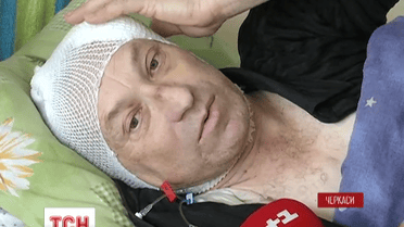В Черкассах сосулька травмировала 53-летнего мужчину
