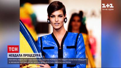 Новости мира: популярная модель 90-х изменилась до неузнаваемости из-за неудачной косметической процедуры