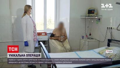 Новини України: львівські хірурги врятували 74-річного пацієнта, в якого розірвалась аневризма черевної аорти
