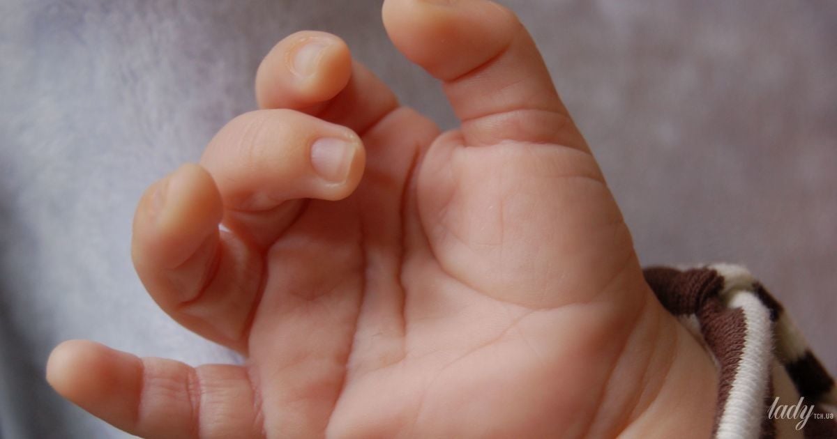Щелкающий палец на руке (болезнь Нотта, стенозирующий лигаментит)