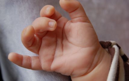 Болезнь Нотта у детей: почему палец "заворачивается" и как его разогнуть