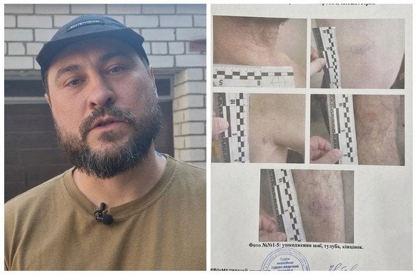 "Я стояв на колінах, і мене пи*дили": у Дніпрі побили ветерана, у ТЦК відповіли і заявили про вимагання грошей (відео)