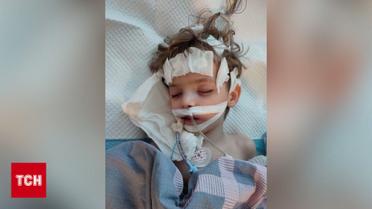 Во Львове шокировали выводами о смерти 5-летнего Велеса после лечения зубов