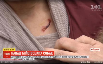 На Киевщине бойцовские собаки, которые гуляют без намордников и поводков, напали на двух женщин