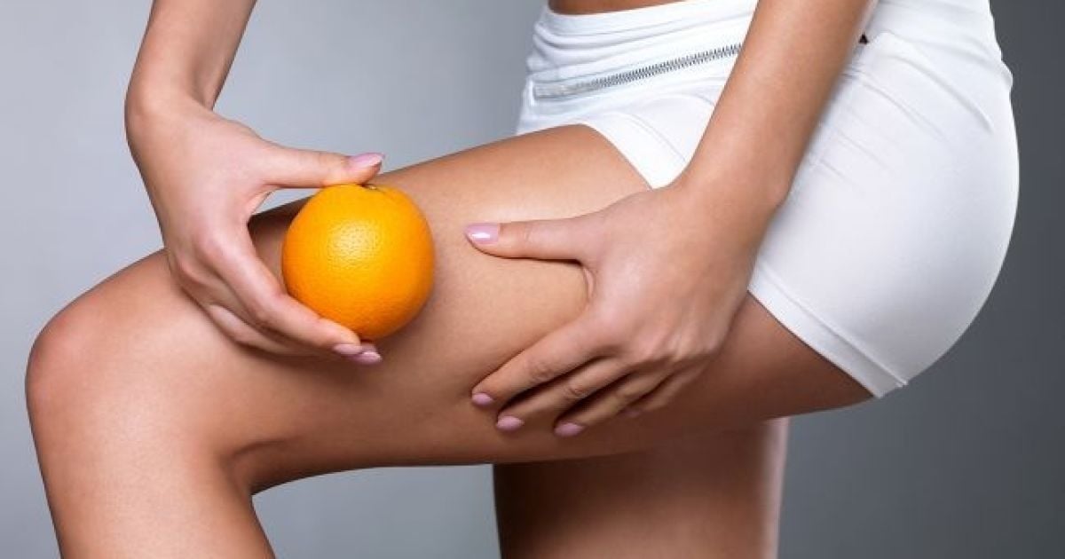 Які продукти викликають целюліт