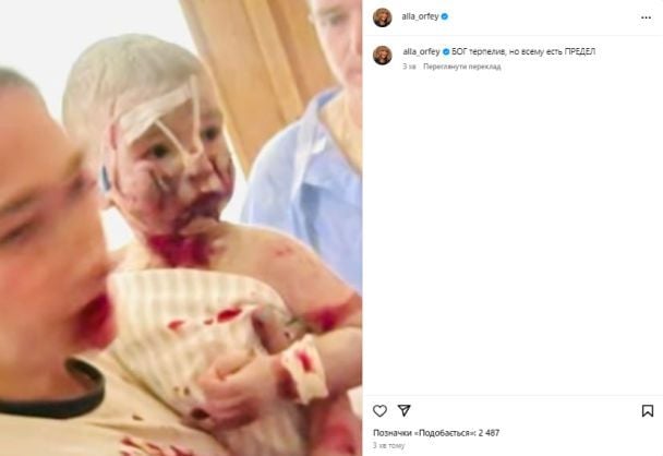 Реакция Аллы Пугачевой на обстрел "Охматдета" / © instagram.com/alla_orfey