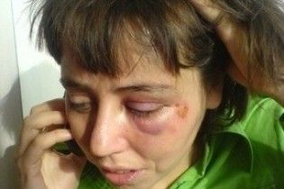 На відкритті клубу побили художницю Кадирову