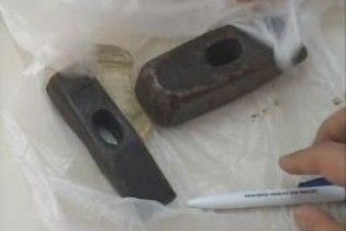 Аби врятуватися від запору, п'яний румун засунув собі у задній прохід скло і молоток