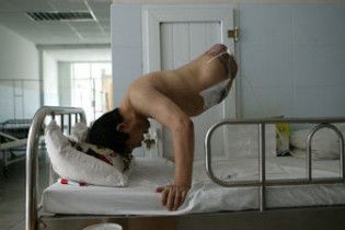 У Китаї чоловік вижив після ампутації більшої частини тіла