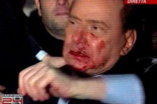 Берлусконі пробачив свого нападника, але вимагає покарати його