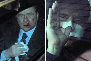 Блогери: напад на Берлусконі був спектаклем