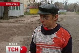 Пітбультерьєр погриз чотирьох людей у Кіровограді