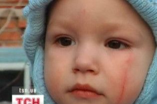 У Запоріжжі мати викинула сина в лісосмугу