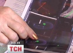 Помилка лікарів