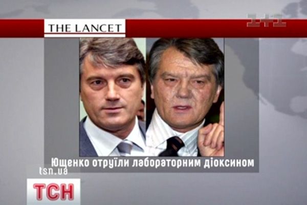 Діоксид