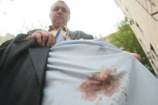 У Києві стріляли у чоловіка, який викрив аферу Флетчера
