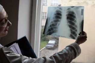 У Молдові від свинячого грипу помер громадянин України