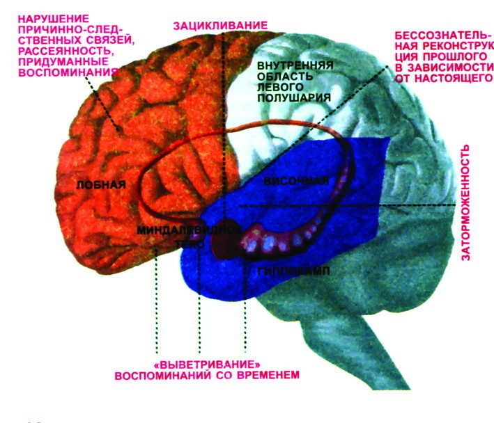 Мозок людини