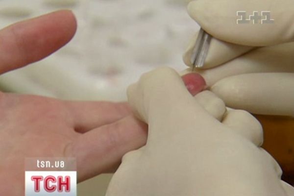 Аналізи