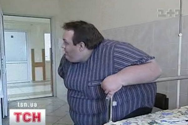 Ожиріння