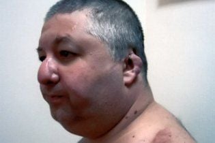 Депутата, которому отрезали уши, посадили за покушение на Кернеса и Добкина