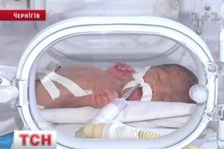 Немовляті з Чернігова потрібна операція, щоб почути світ