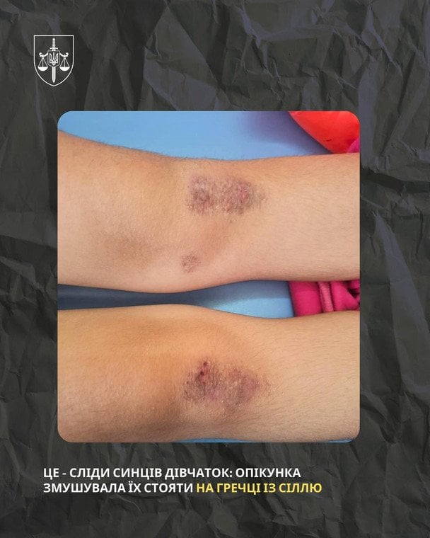 На Полтавщині судитимуть опікунку за катування молодших сестер. / © Офіс Генерального прокурора