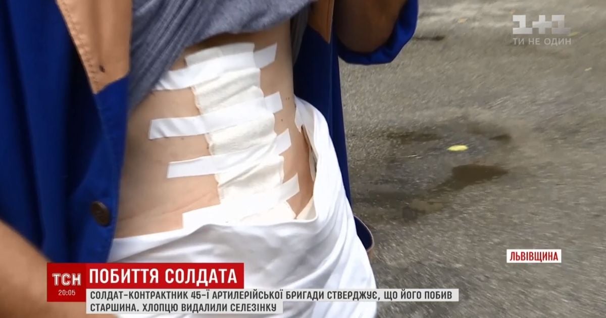 Солдат-артилерист звинуватив старшину в побитті до каліцтва на Львівщині