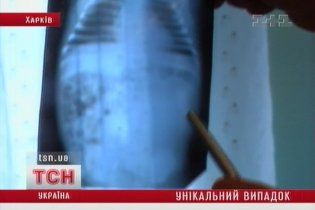 Украинские врачи спасли младенца с близнецом в животе
