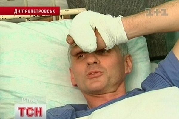 Потерпілий