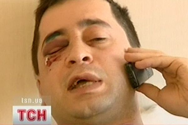 Побитий грузинський спостерігач