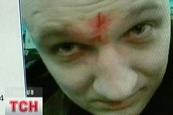 Побитий чоловік