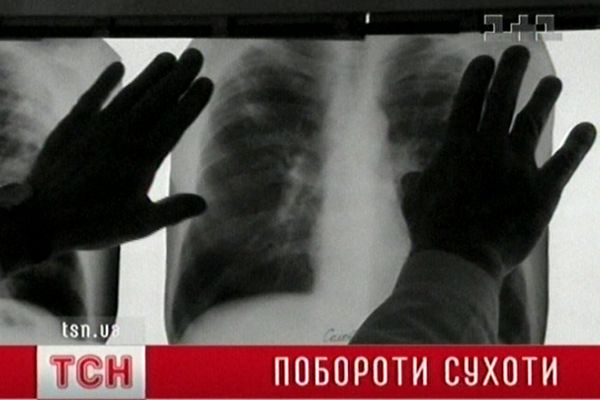 Рентгенівський знімок